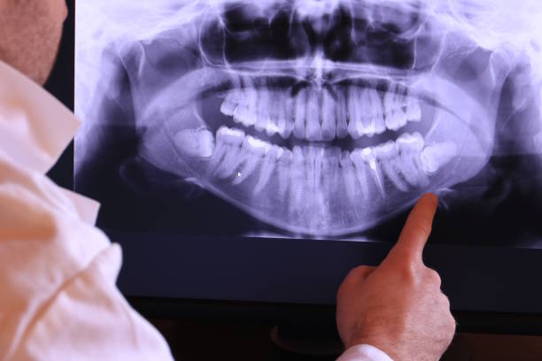 Best Emergency Gum Treatment in Sealy, TX